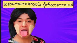 အဆင့်(၁)ရတဲ့ ဟာမ ဘယ်လိုဖားလည်းကြည့်လိုက်