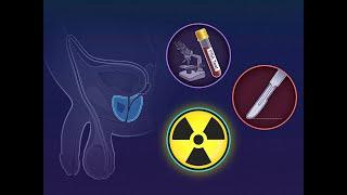 Monitoring, Surgery, or Radiotherapy for Prostate Cancer | NEJM