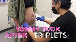 Plastic Surgeon: How I Flattened Her Tummy After Triplets!