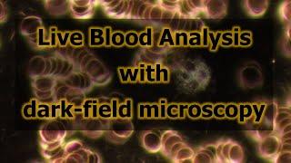 Live Blood Analysis with dark-field microscopy