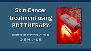 Non-Surgical Treatment of Skin Cancer with Photodynamic Therapy (PDT)