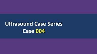 Ultrasound Case 004