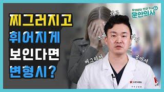 찌그러지고 휘어지게 보인다면 변형시?｜변형시