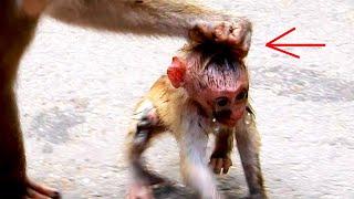 ohGod... Cute Baby. What Happened Baby? | Nice Clip Baby Monkey | Cute Baby