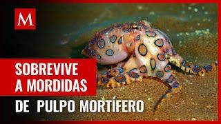 Mujer sobrevive tras ser mordida por un pulpo capaz de causar la muerte