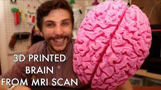 Life-Size 3D Printed Brain From MRI Scan!