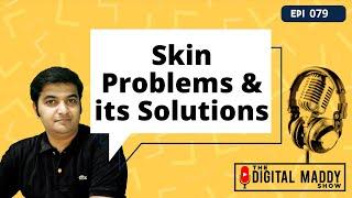 Skin Problems & its Solution by Dr Pratibha | The Digital Maddy Show | Digital Mitthyl
