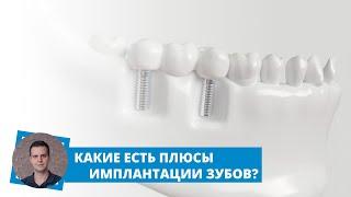 Какие есть плюсы имплантации зубов?