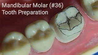 Dr VK's Dental Skool | MANDIBULAR FIRST MOLAR PREPARATION |ALL CERAMIC | METAL CERAMIC (PFM) CROWN