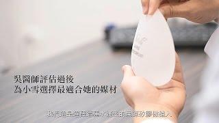 水滴型隆乳手術打造自然後天美胸，台北教主醫美整形吳孟穎醫師案例，水滴隆乳手術日記心得分享