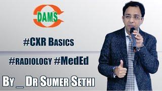 #CXR Basics - By Dr. Sumer Sethi #radiology #MedEd