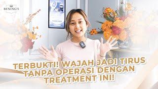 TERBUKTI! Wajah jadi tirus tanpa operasi dengan treatment ini!