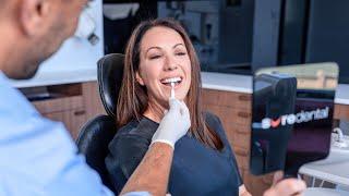 What Are Feldspathic Porcelain Veneers and How Do They Compare to Other Types?