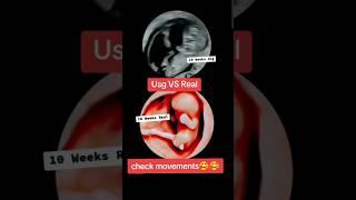 10 weeks real vs Usg check movements ultrasound|#viralvideo #trending #baby