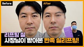 실리프팅 효과를 반쪽시술으로 보여드려요! - 자보실 풀페이스 리프팅 시술 전후