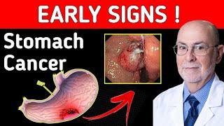 Sign and symptoms of stomach Cancer