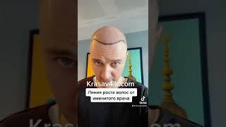 Линия роста волос от именитого врача. Как? Подходит мне больше? #красавчик #линияроставолос