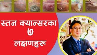 7 Symptoms of breast cancer (स्तन क्यान्सरका ७ लक्षणहरू) | Dr. Kapendra Shekhar Amatya