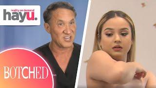 Dr. Dubrow Confirms This The WORST Botched Boob Job EVER! | Season 6 | Botched