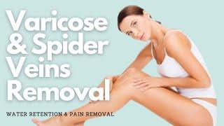  Get Rid of Varicose and Spider Veins + Water Retention and Pain Removal ~ Classical Music