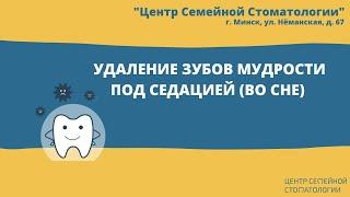 Удаление зубов мудрости под наркозом. Седация в стоматологии. Удаление зубов мудрости во сне