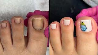 TRANSFORMAÇÃO NAS UNHAS DOS PÉS | DICAS PARA INICIANTES