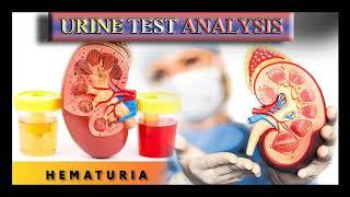 Urine Test ,Urinalysis Interpretation Explained Clearly #by Harib Lab