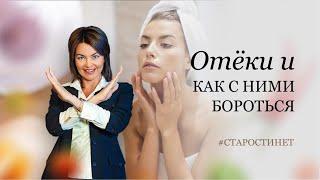 Отёки и как с ними бороться. / доктор Елена Бахтина, организатор движения "Старости нет"