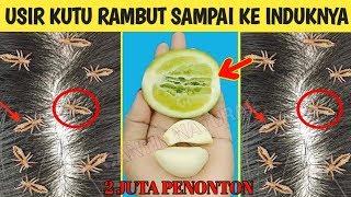 cara mudah menghilangkan Kutu Rambut secara permanen || Dengan Bahan Alami