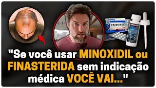 MINOXIDIL e FINASTERIDA realmente funcionam contra QUEDA DE CABELO?