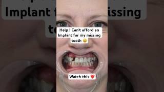 Missing tooth ??? Nesbit! Affordable option to replace that missing tooth