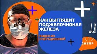 ДМИТРИЙ САВЕНКОВ I ОТКРЫТАЯ ОПЕРАЦИЯ НА  ПЖ I БРЮШНАЯ ПОЛОСТЬ