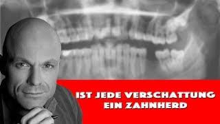 ist jede verschattung ein zahnherd