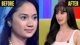 Famous Filipina Celebrities Plastic Surgery Disasters - PART 2