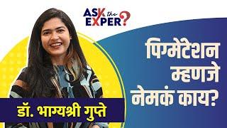 पिग्मेंटेशनची समस्या तुम्हालाही आहे का ?| How to Get Rid of Pigmentation On Face | Lokmat Sakhi