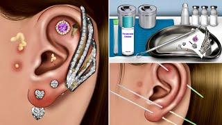 ASMR Ear Piercing Cleaning Animation, Blackhead, Removing Pus from Piercing, Make-up