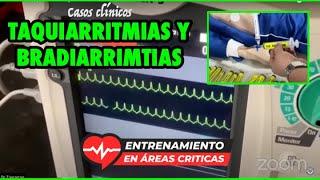 Taller de Taquiarritmias y Bradiarrimtias