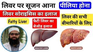 Fatty Liver ka Unani ilaaj | liver sirosis ka ayurvedic ilaaj |hepatitis ka Unani ilaaj | Unani Gyan