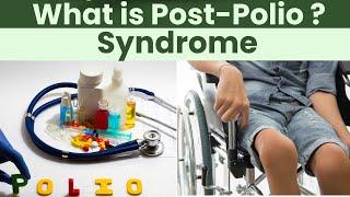 Post Polio Syndrome : Causes, Symptoms, and Treatment