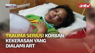 ART KORBAN PENGANIAYAAN DIPERIKSA CT SCAN | Topik Terkini