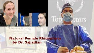 Natural Female Rhinoplasty by Dr. Ali Sajjadian | plastic Surgery in Newport Beach!