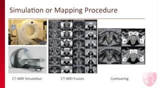 Stanford Radiation Oncologist Explains Radiation Therapy Treatment for Prostate Cancer