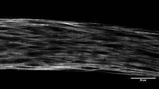 Video 2 SHG 3D imaging of collagen fibers