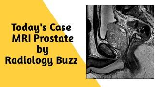 MRI Prostate - What is your diagnose?