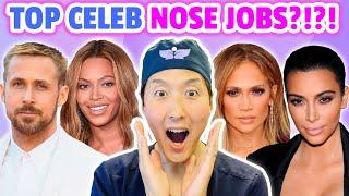 Plastic Surgeon Reveals The Top Five Best Celebrity Nose Jobs!