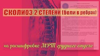 Левосторонний СКОЛИОЗ ГРУДНОГО ОТДЕЛА позвоночника 2 степени на РАСШИФРОВКЕ МРТ. Сколиоз причины.