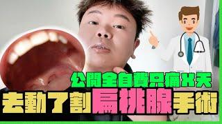 我去割了扁桃腺！！！　全身麻醉還要住院！｜Tonsillitis手術經驗分享｜納斯想怎樣