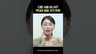 [양악+윤곽+안면거상] 수술 전후 비교 #shorts