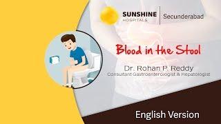 Blood in the Stools (English) | Dr. Rohan P. Reddy | Gastroenterologist & Hepatologist