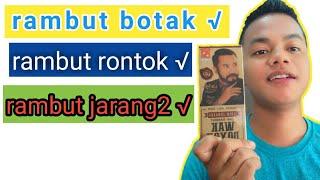 selamat tinggal rambut botak dan rontok